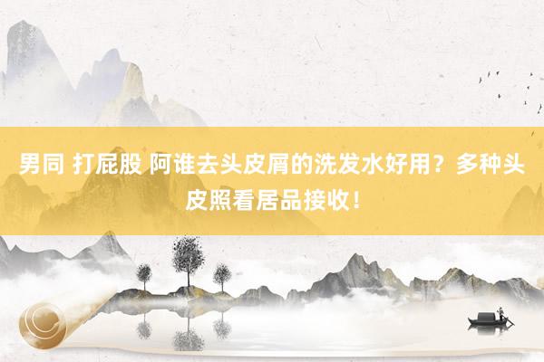 男同 打屁股 阿谁去头皮屑的洗发水好用？多种头皮照看居品接收！